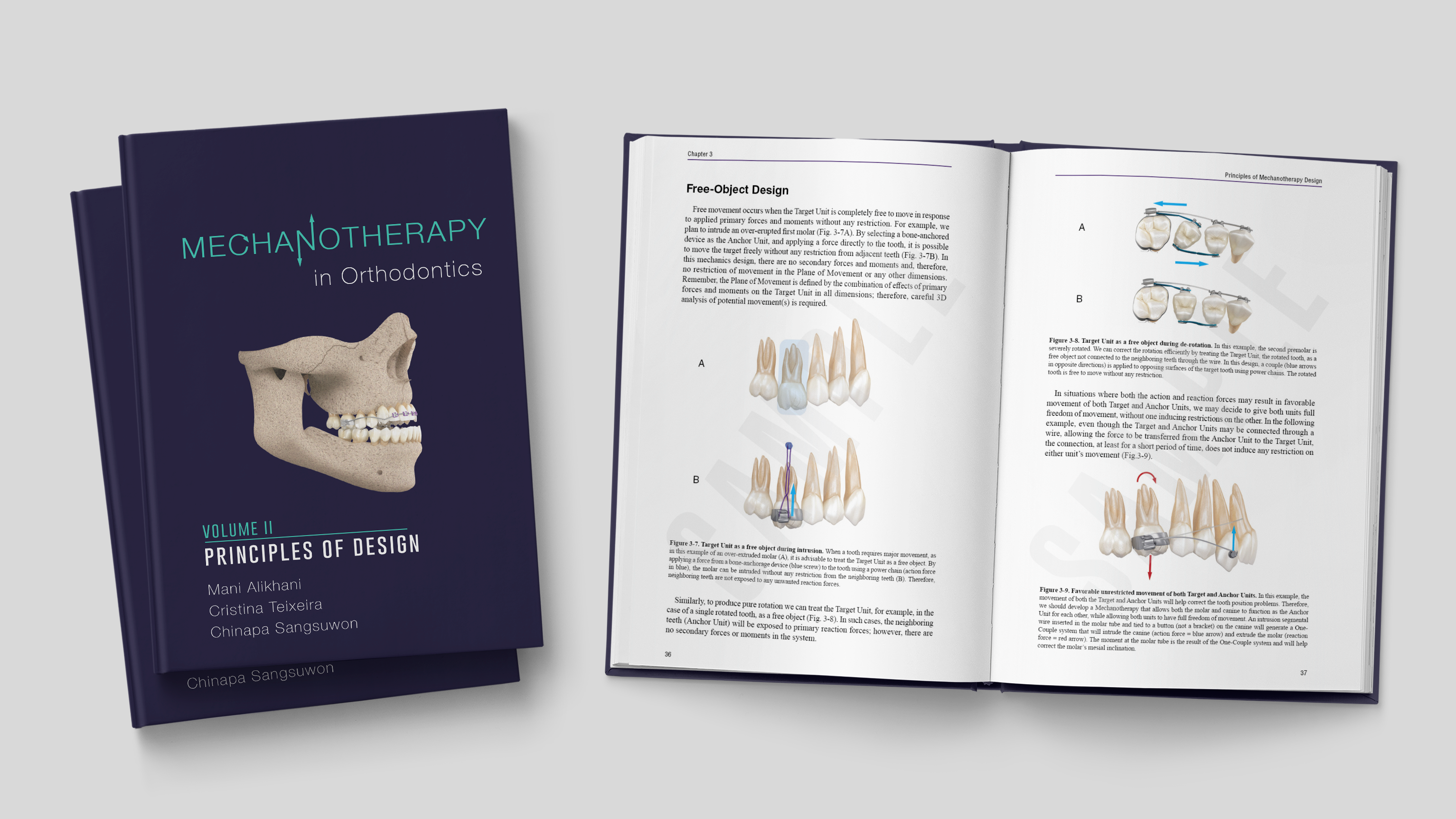 Mechanotherapy in Orthodontics Vol. II: Principles of Design